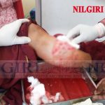 தேயிலைத் தோட்டத்தில் தேயிலை பறித்துக் கொண்டு இருந்தவர்கள் மீது கரடி தாக்கியது