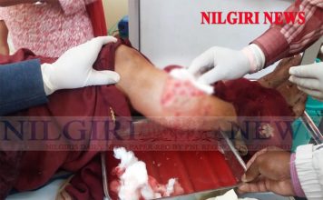 தேயிலைத் தோட்டத்தில் தேயிலை பறித்துக் கொண்டு இருந்தவர்கள் மீது கரடி தாக்கியது